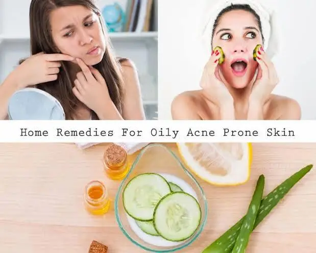 Read more about the article What causes oily skin and how to get rid of oily acne prone skin?